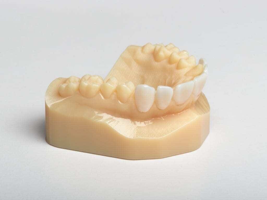 Modelo de arcada dentária impressa em 3D na cor bege. Dentes da parte inferior da boca posicionados na frente brancos.